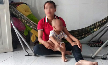 Đánh sưng má bé 19 tháng tuổi, bảo mẫu nói dối bé ngã cầu thang