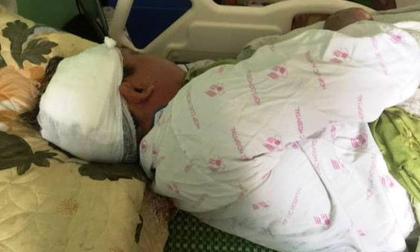 Nhóm côn đồ bịt mặt xông vào nhà, chém người đàn ông nhập viện