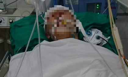 Con bị đánh chấn thương sọ não, mẹ đau xót cầu cứu cộng đồng mạng