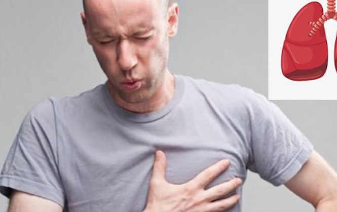Dấu hiệu những cơn ho 'chết người' cảnh báo ung thư phổi - 1