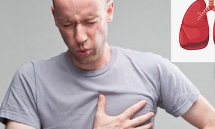 Dấu hiệu những cơn ho 'chết người' cảnh báo ung thư phổi