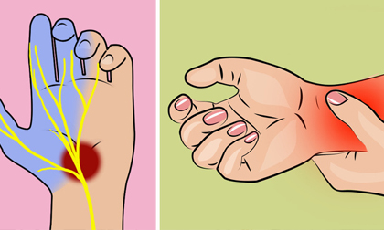 Khi thấy tay hoặc chân thường xuyên bị tê, hãy dè chừng những bệnh nguy hiểm sau