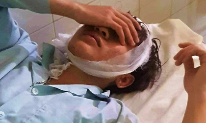 6 thanh niên bị chém trọng thương khi đi uống cà phê