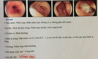 Bố mẹ tá hoả khi biết con 5 tuổi bị viêm dạ dày, bệnh tưởng chỉ có ở người lớn