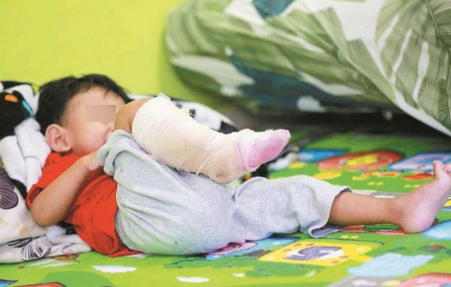Con bị nhiễm vi khuẩn ăn thịt người, mẹ hối hận tột độ vì đã phớt lờ điều tưởng chừng như vô hại này