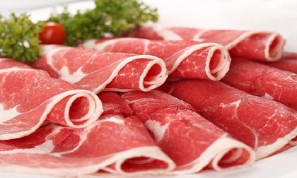 Bác sĩ chỉ điểm 5 nguyên nhân gây bệnh sỏi thận hàng đầu hiện nay, số 1 rất quen mặt