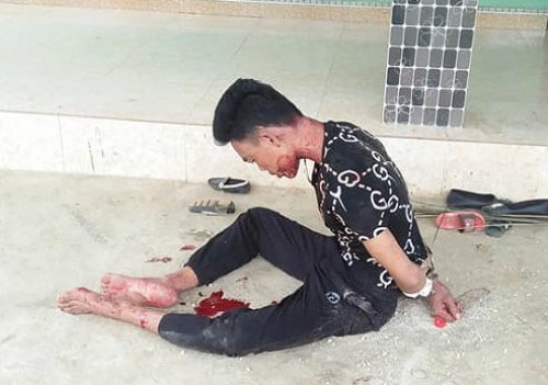 An ninh - Hình sự - Vụ chồng giết vợ, ôm thi thể trong nhiều giờ: Xác định nguyên nhân nạn nhân tử vong