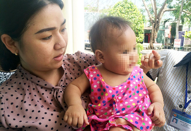 Bé gái 8 tháng tuổi nghi bị mẹ nuôi bạo hành, nhốt trong phòng trọ