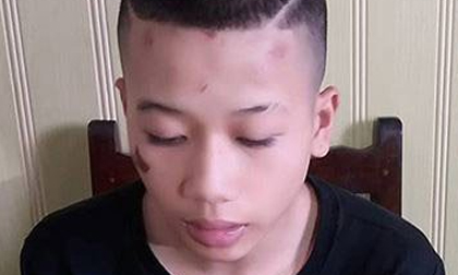 Khởi tố thanh niên giết người vì có tình cảm với 'gái dịch vụ'