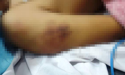 Nghi phạm đánh bạc tử vong sau khi bị tạm giam