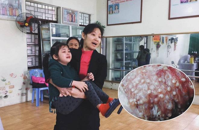 nong: ca giao vien truong mam non o bac ninh cung nhiem san lon gao - 1