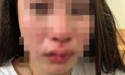 Vụ “hotgirl” bị giật quần, hành hung: Không có chứng cứ ngoại tình?