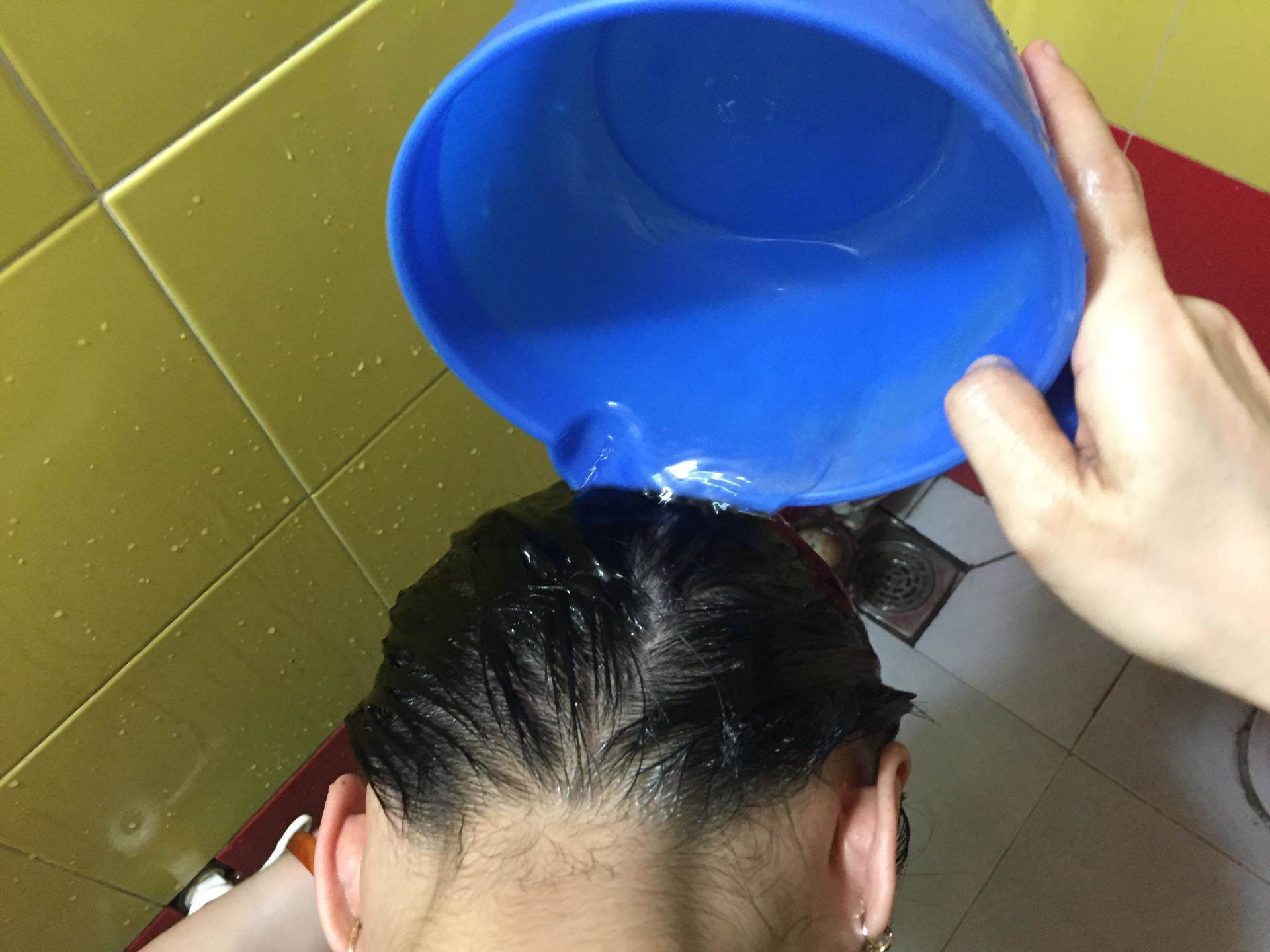nghe si anh vu nghi qua doi vi dot quy do tam dem, bac si li giai su that - 2