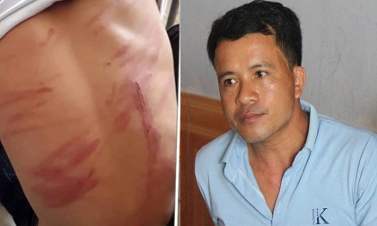 Vụ bé trai bị bố ruột bạo hành đến mức ngất xỉu, nhập viện: 'Ông ấy đánh cháu hơn 30 phút'