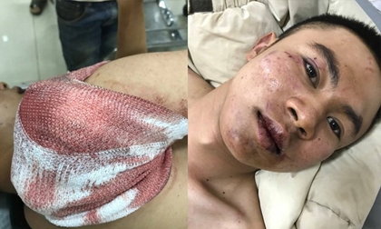 Đi đòi nợ, thanh niên 9X bị chém tới tấp phải nhập viện trong tình trạng nguy kịch