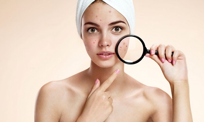 Bỗng nhiên mọc mụn ở những vị trí này, hãy đến bệnh viện khám ngay lập tức kẻo hối không kịp