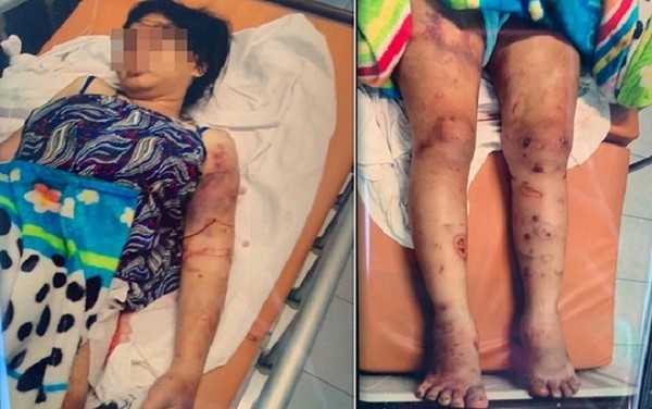 Vụ thai phụ 6 tháng bị bắt cóc, tra tấn dã man suốt 20 ngày đến sẩy thai: 2 kẻ chủ mưu đã bỏ trốn Vụ thai phụ 6 tháng bị bắt cóc, tra tấn dã man suốt 20 ngày đến sẩy thai: 2 kẻ chủ mưu đã bỏ trốn