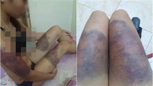 Vụ thai phụ 6 tháng bị bắt cóc, tra tấn dã man suốt 20 ngày đến sẩy thai: 2 kẻ chủ mưu đã bỏ trốn Vụ thai phụ 6 tháng bị bắt cóc, tra tấn dã man suốt 20 ngày đến sẩy thai: 2 kẻ chủ mưu đã bỏ trốn