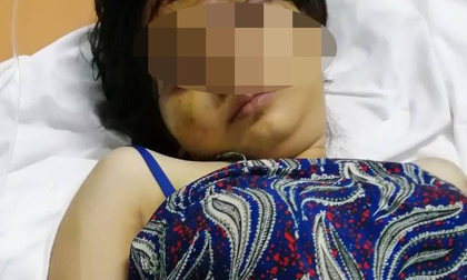 20 ngày kinh hoàng của thai phụ bị giam cầm, tra tấn làm chết thai nhi