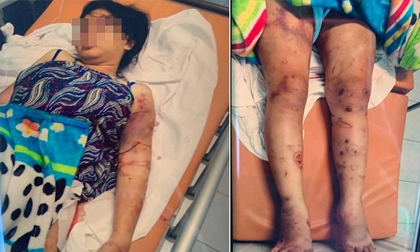 Vụ cô gái trẻ bị 'bắt cóc', tra tấn đến sinh non ở Sài Gòn: Đối tượng khai đã sử dụng ma túy trong lúc hành sự