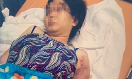 Khởi tố đối tượng tra tấn cô gái đến sẩy thai