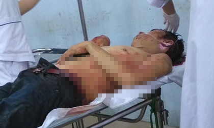Bắt nghi phạm chém hàng xóm 17 nhát vì chê 'hát như nhạc đám ma'
