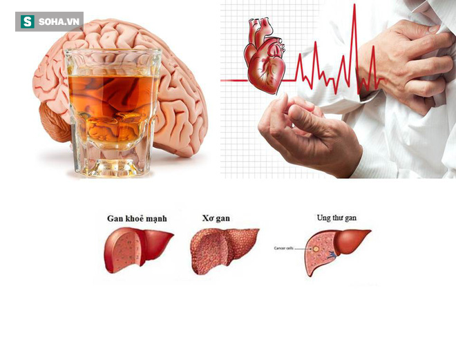 Uống rượu bia thường xuyên: 5 cơ quan nội tạng bốc hơi đáng giật mình