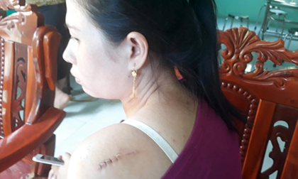Phút kinh hoàng của cô dâu bị chồng cũ rượt chém tại tiệc cưới