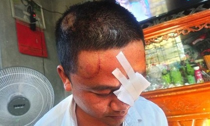 Huế: 3 mẹ con bị hàng xóm đuổi đánh, dùng dao chém trọng thương vì 'ngứa mắt' tấm lưới rào gà