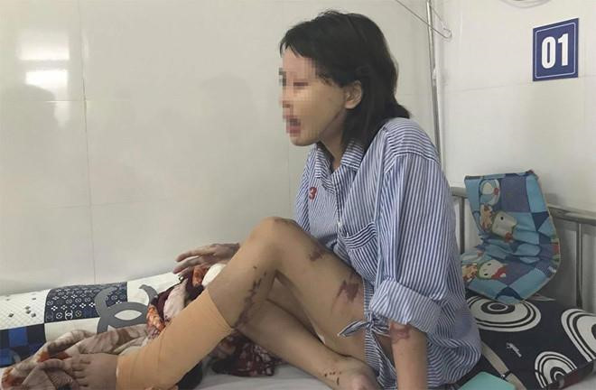 Vụ cô gái bị tạt axit: Bác sĩ ám ảnh vì một nửa khuôn mặt cháy đen Vụ cô gái bị tạt axit: Bác sĩ ám ảnh vì một nửa khuôn mặt cháy đen