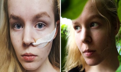 Cô gái 17 tuổi bị hãm hiếp dùng quyền trợ tử để kết thúc cuộc đời