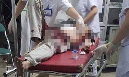 Mâu thuẫn, con rể dùng dao đâm bố mẹ vợ trọng thương