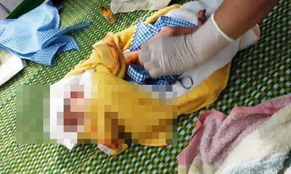 Phát hiện bé sơ sinh còn nguyên dây rốn treo trên xe máy