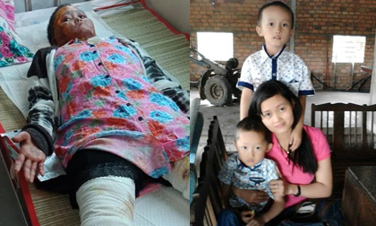 Chồng tẩm xăng thiêu sống, mẹ xinh đẹp bị biến dạng mặt, con gặp lần đầu ngất lịm