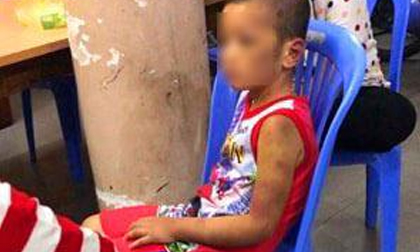 Mẹ và bạn tình đồng tính bạo hành con: Bé bị tra tấn hằng ngày bằng tay chân, cán chổi