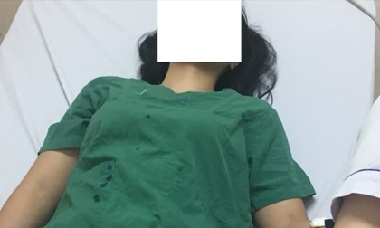 Nữ bác sĩ sản khoa bị người nhà bệnh nhân đấm bầm mặt tại bệnh viện
