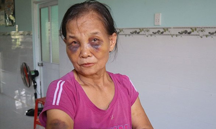 Con dâu túm tóc đánh mẹ chồng sưng mắt, tím mặt khiến MXH dậy sóng