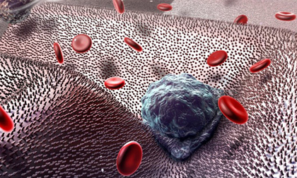 Dùng vitamin theo cách này là ngầm giúp tế bào ung thư di căn khắp cơ thể