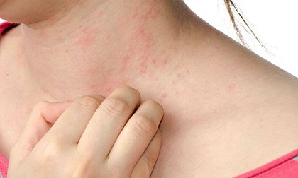Người phụ nữ bị ung thư da giai đoạn cuối, nguyên nhân đã xuất hiện từ 22 năm trước