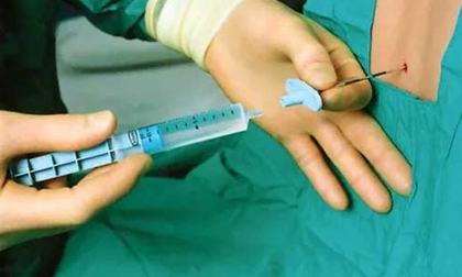 Sản phụ 28 tuổi bất ngờ tử vong khi sinh mổ bằng phương pháp gây tê tuỷ sống