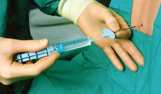 Sản phụ 28 tuổi bất ngờ tử vong khi sinh mổ bằng phương pháp gây tê tuỷ sống Sản phụ 28 tuổi bất ngờ tử vong khi sinh mổ bằng phương pháp gây tê tuỷ sống