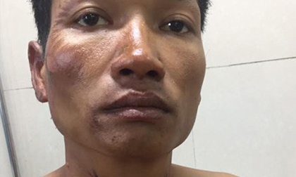 Lên cơn ghen, phóng hoả đốt nhà rồi dìm chết vợ dưới bể nước
