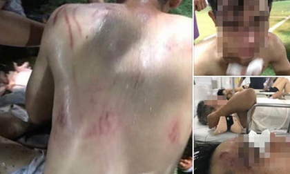 Thực hư chuyện giao hữu bóng đá với đối thủ bắt qua mạng, cả đội bị đánh nhập viện