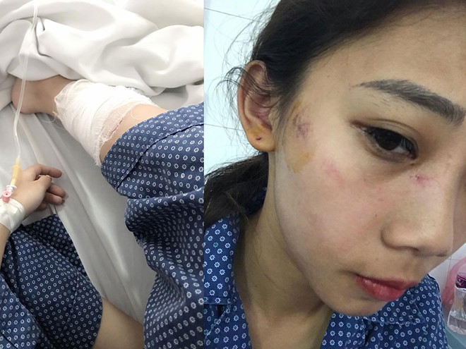Hà Nội: 2 cô gái trẻ bị nhóm thanh niên trêu ghẹo, hành hung phải nhập viện Hà Nội: 2 cô gái trẻ bị nhóm thanh niên trêu ghẹo, hành hung phải nhập viện