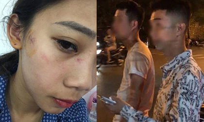 Hà Nội: 2 cô gái trẻ bị nhóm thanh niên trêu ghẹo, hành hung phải nhập viện
