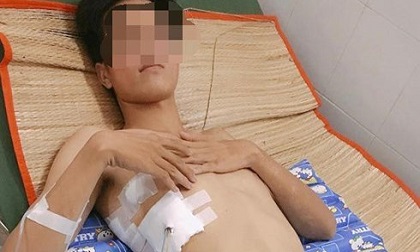 Thanh niên 23 tuổi “chết đi sống lại” xin các bạn trẻ hãy bỏ thuốc