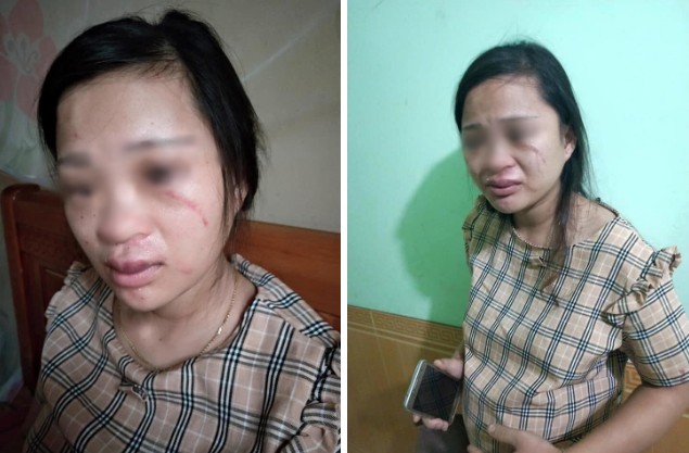 Diễn biến bất ngờ vụ thai phụ 8 tháng bị chồng đánh vì mua giày online giá 135 ngàn - Ảnh 2.