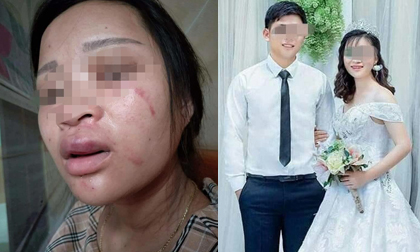 Diễn biến bất ngờ vụ thai phụ 8 tháng bị chồng đánh vì mua giày online giá 135 ngàn đồng