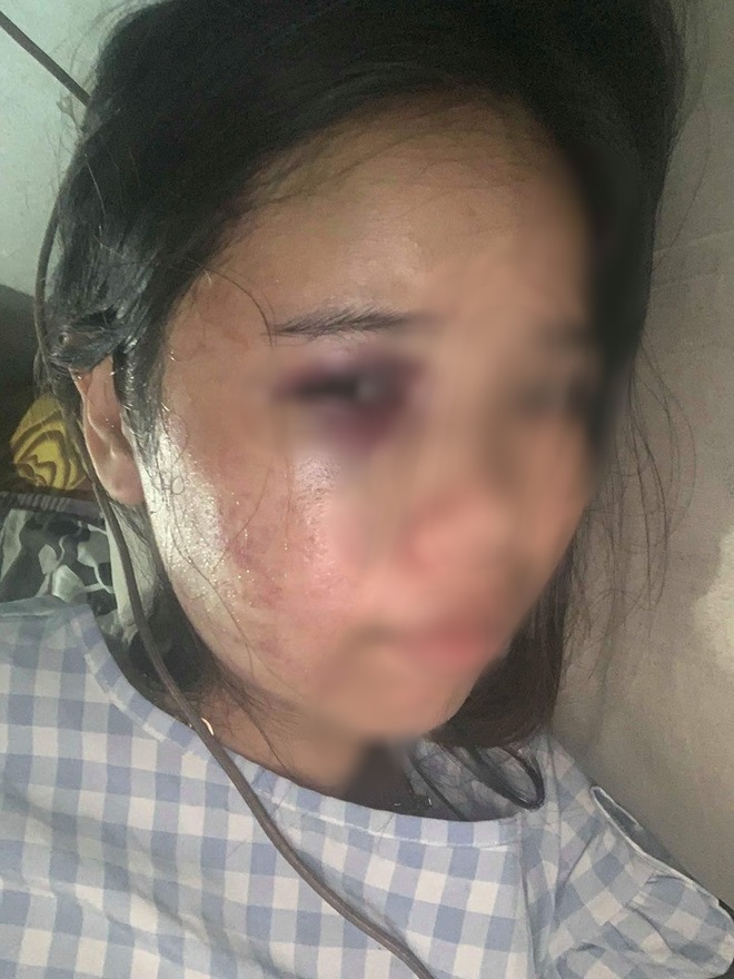 Xót xa những người vợ bầu vượt mặt vẫn đau đớn chịu nhiều trận bạo hành của chồng vũ phu - 2