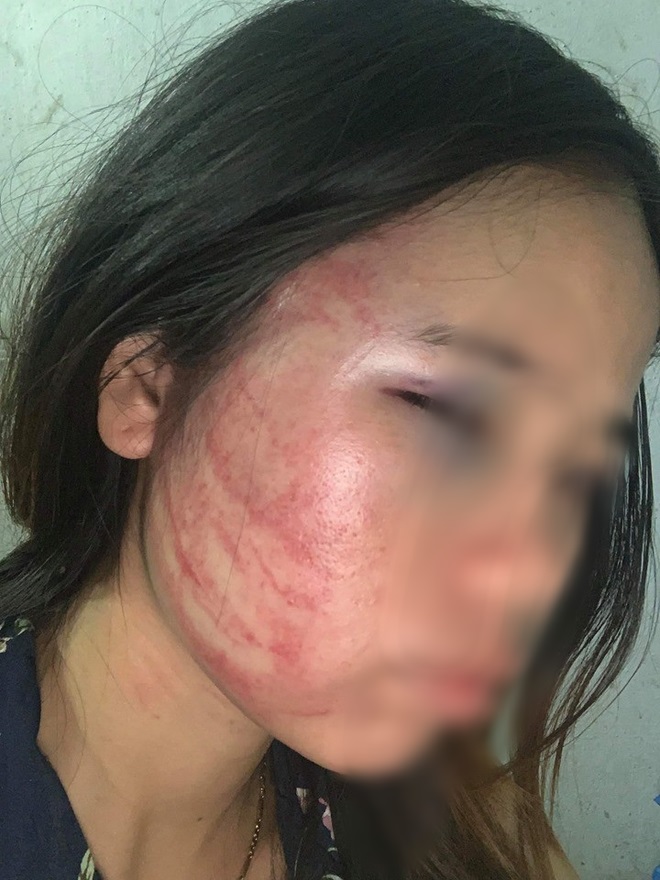 Xót xa những người vợ bầu vượt mặt vẫn đau đớn chịu nhiều trận bạo hành của chồng vũ phu - 3